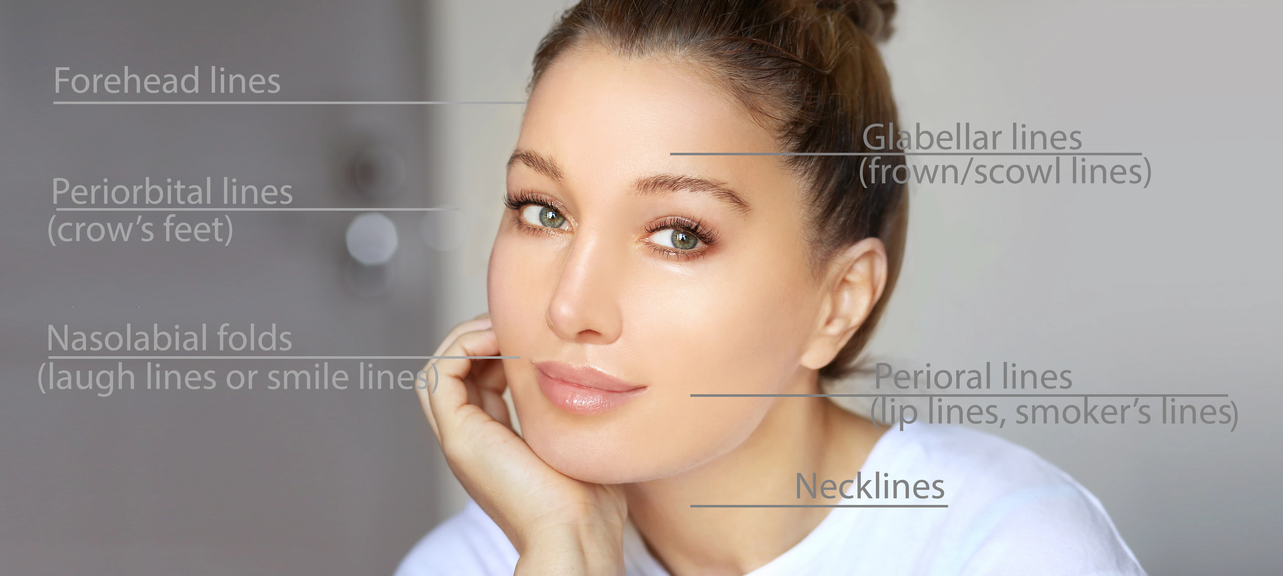 Antiwrinkleinjections