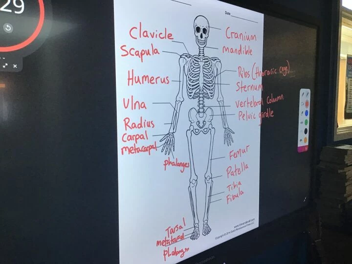 Bones1