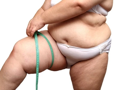obese female