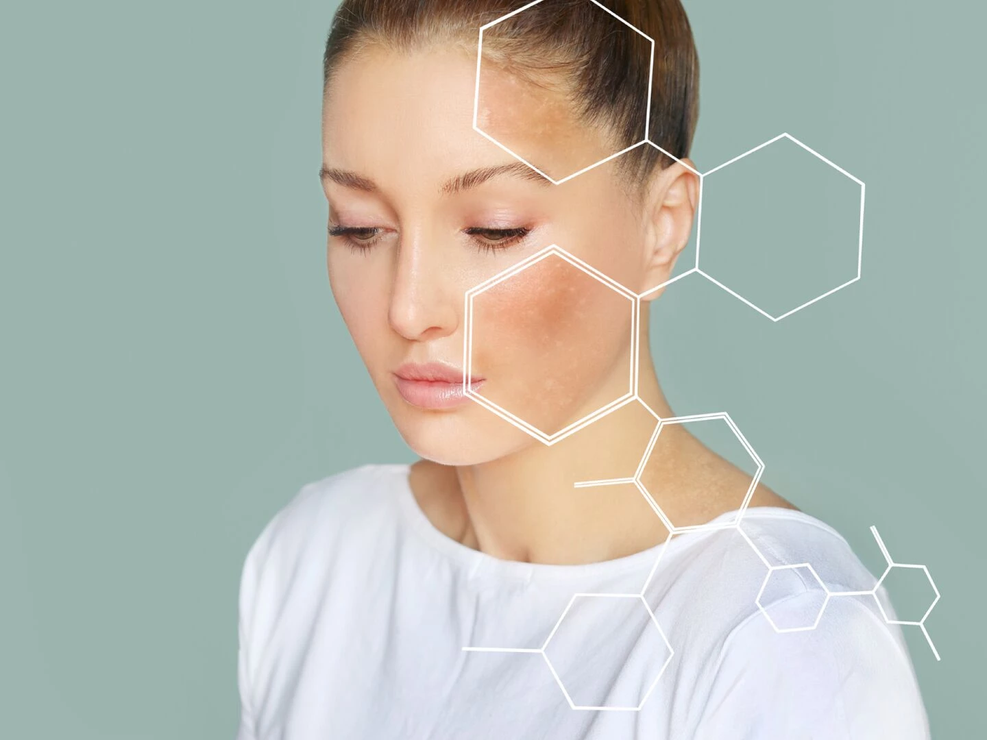 skin booster