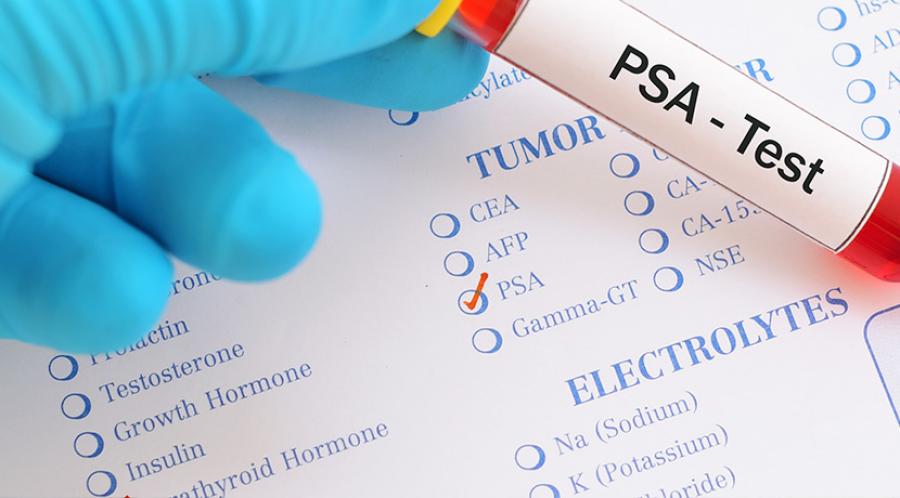 Prostate Cancer Tests 7877